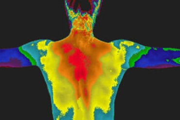 Medical thermography